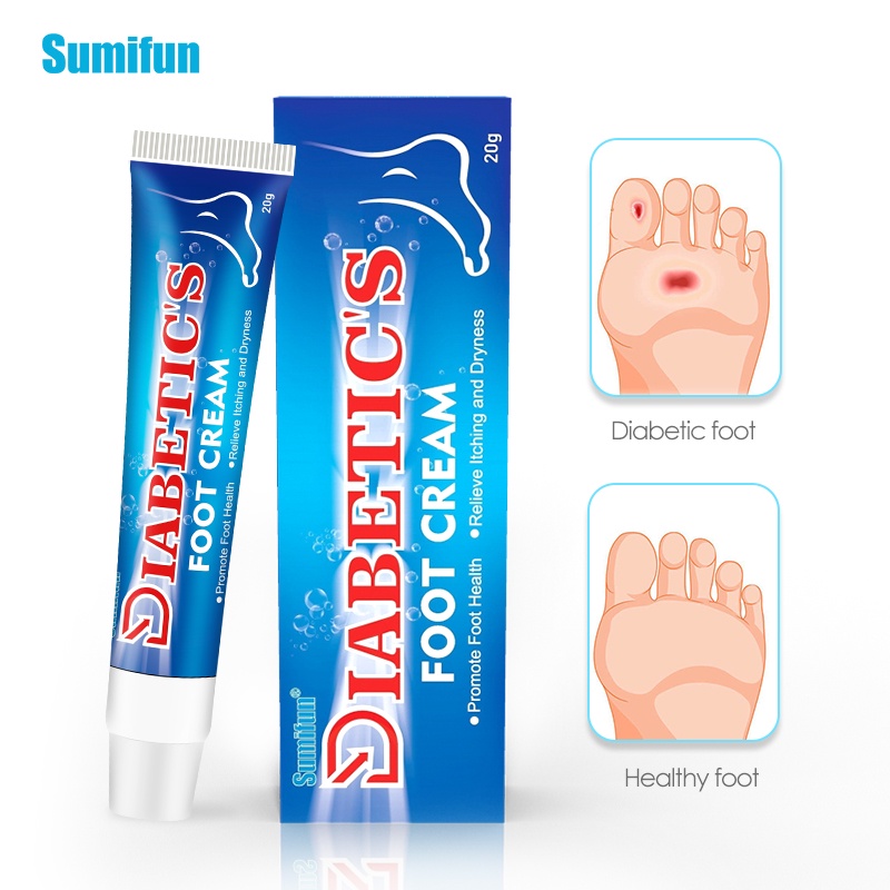 1Pc Sumifun Diabetic Foot Treatment Cream Anti Inflammation Foot