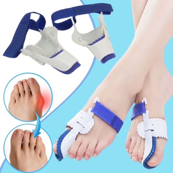 1 pair of orthodontic relief splints, hallux valgus, foot pad support ...