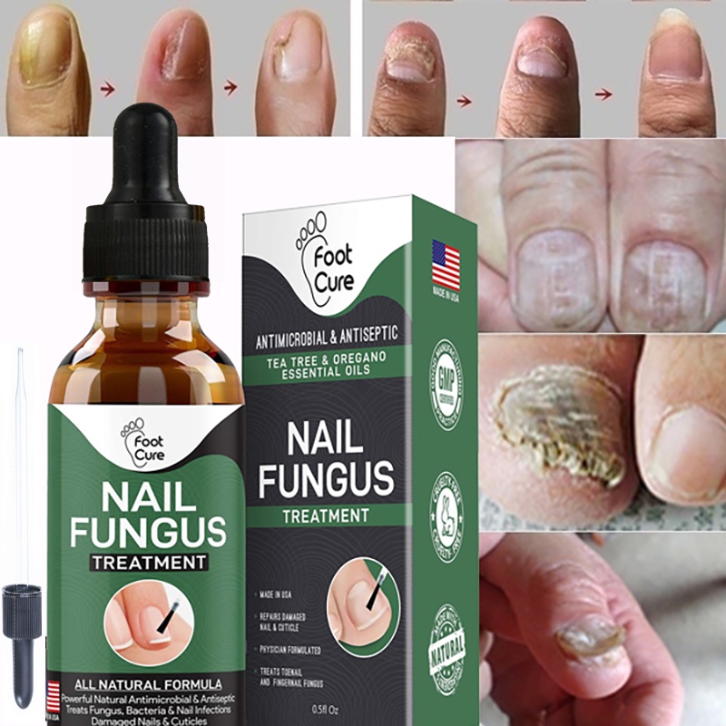 New Dropper EXTRA STRONG Nail Fungus Treatment, Best Nail Repair, Stop