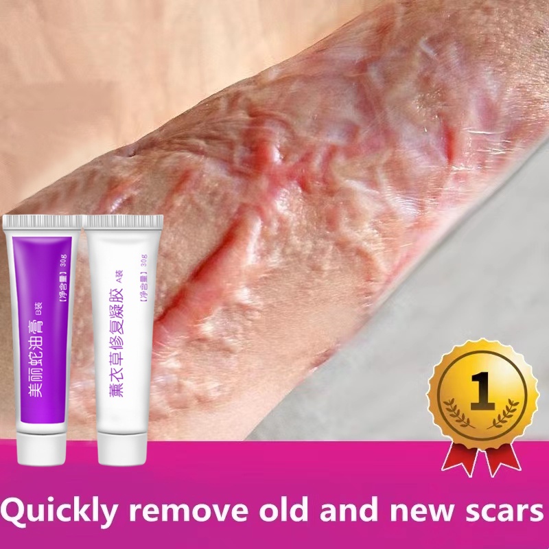 Scar repair cream Remove stretch mark scald Scar Various scars Skin