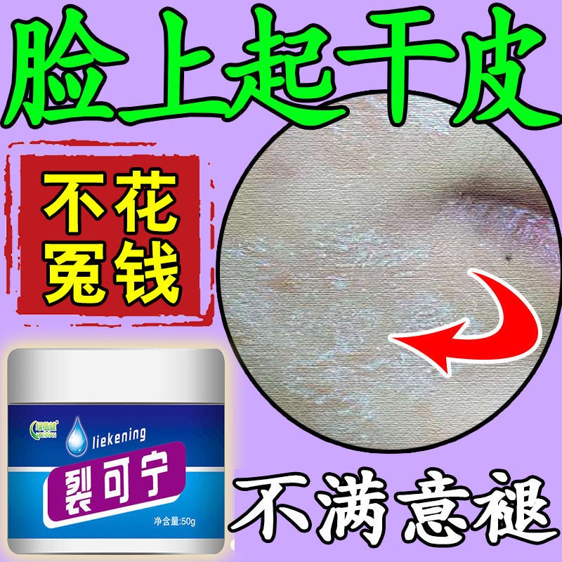 [Dry skin on the face] Peeling, dry skin, itching, peeling