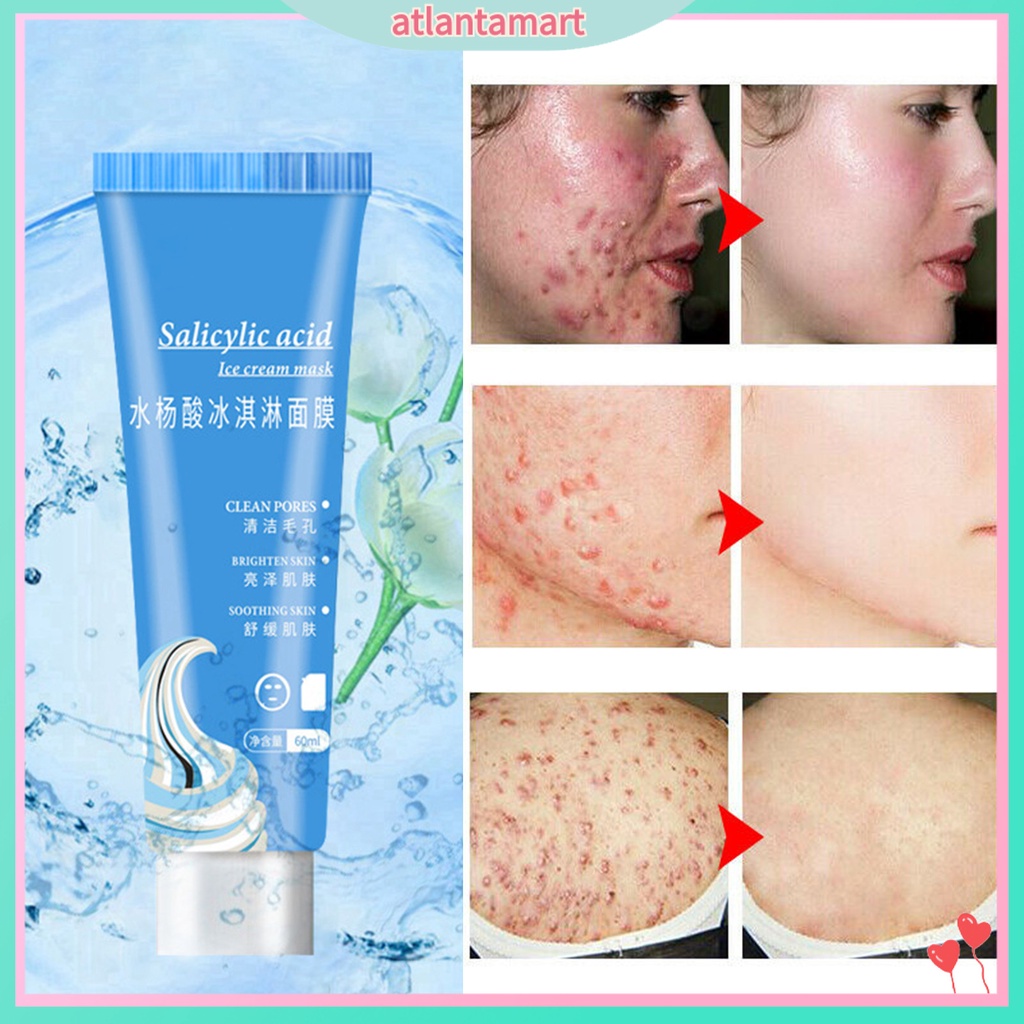 AM Salicylic Acid Acne Scars Blackhead Removal Hydrating Moisture Skin