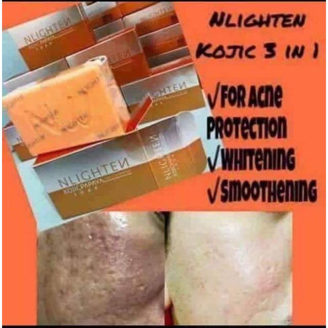 nlighten kojic papaya with glutathione NLIGHTEN KOJIC SOAP (3-in-1) Kojic + Papaya + Glutathione Soap. Bes Triple  whitening effect