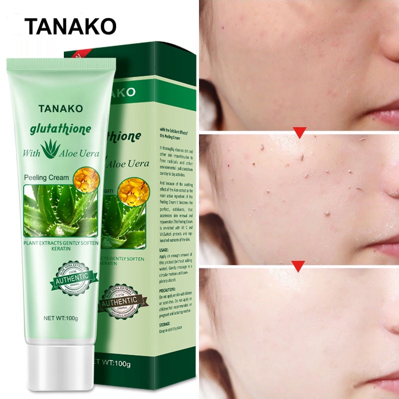 glutathione with aloe vera peeling cream Glutathione with Aloe Vera Peeling Cream Plant Extracts Gently Soften