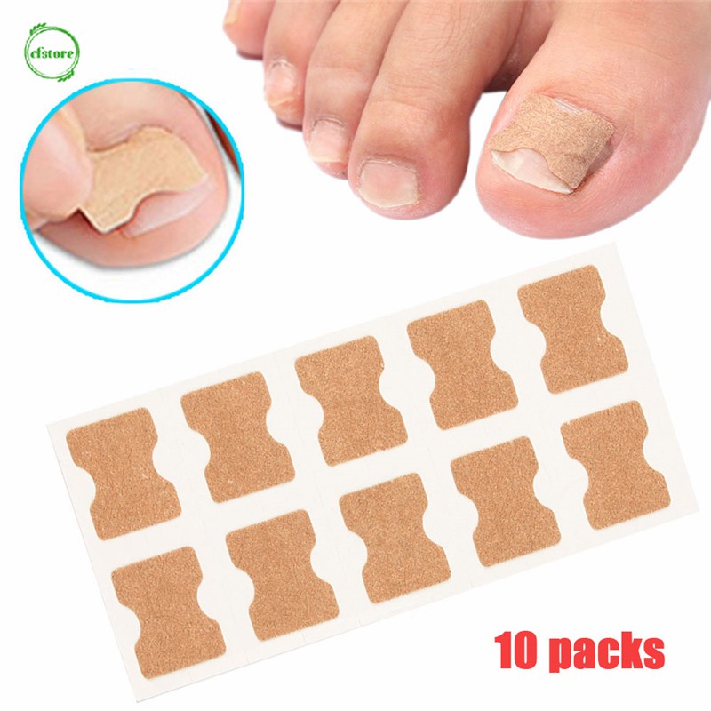 CF Nail Correction Sticker Ingrown Toenail Corrector Stickers