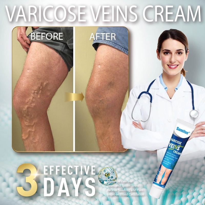 varicose vein remover cream veins effective patch original veins care