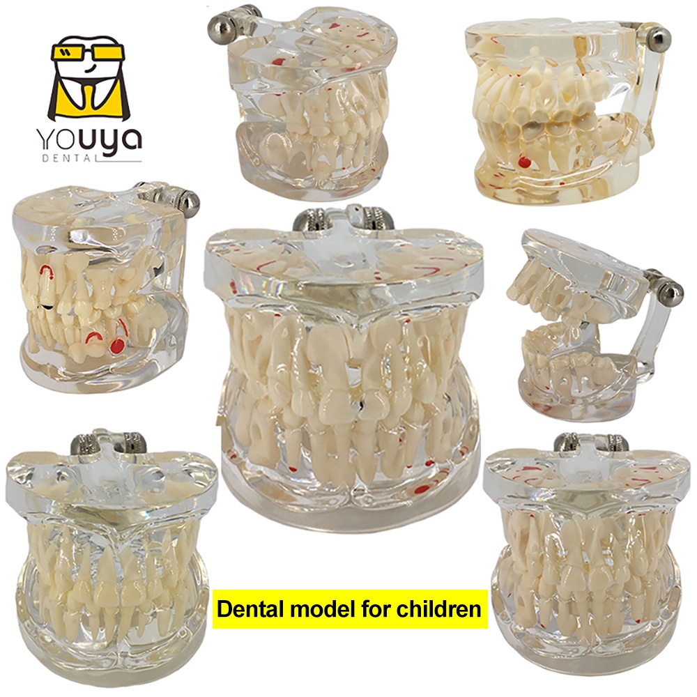 thumbnail interactive-video image 1 of ALAN Pediatric Pathology Demonstration Tooth Model – Children's Dental Study Typodont 4002 1 of 5