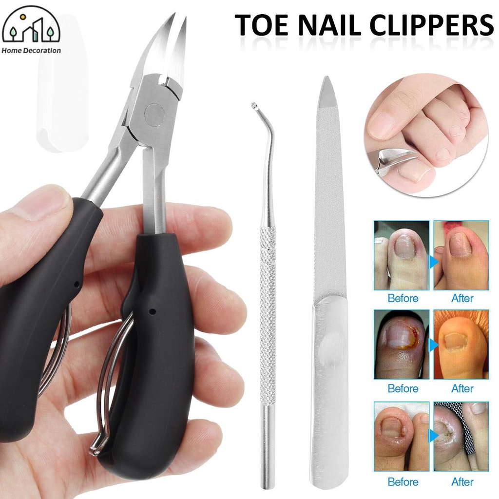 Toenail Cutters Toe Nail Clipper for Ingrown and Thick Toenails ...