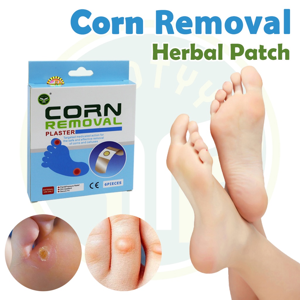 [6 Pathes/Box] Corn Removal Patch | Callus Removal Plaster | Wart ...