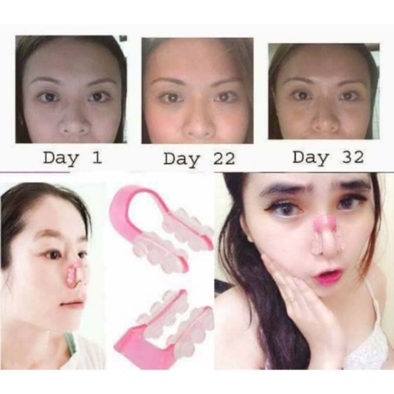 1piece nose up nose lifting clip nose lift up/nose clip/nose up clipper