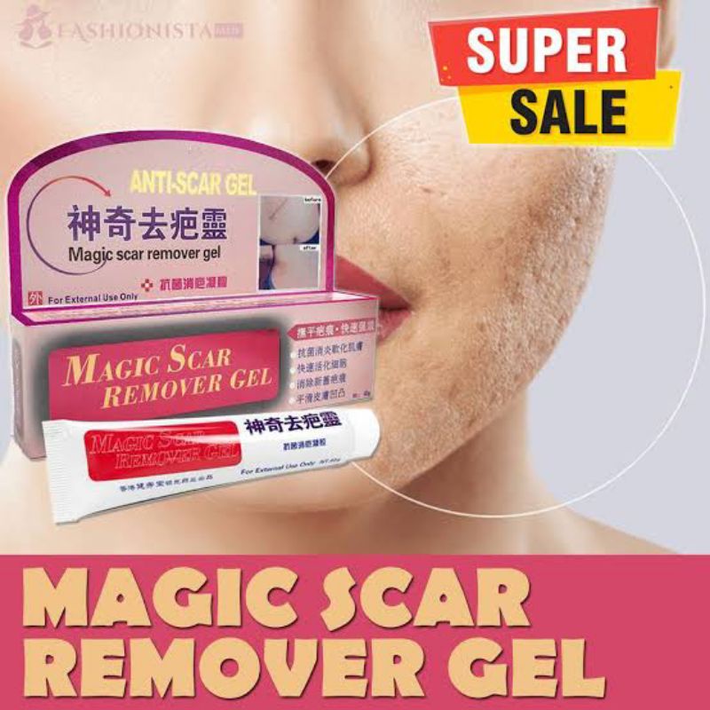 Magic Scar Remover Gel Anti Scar Gel Magic Scar Remover Gel Red 2021