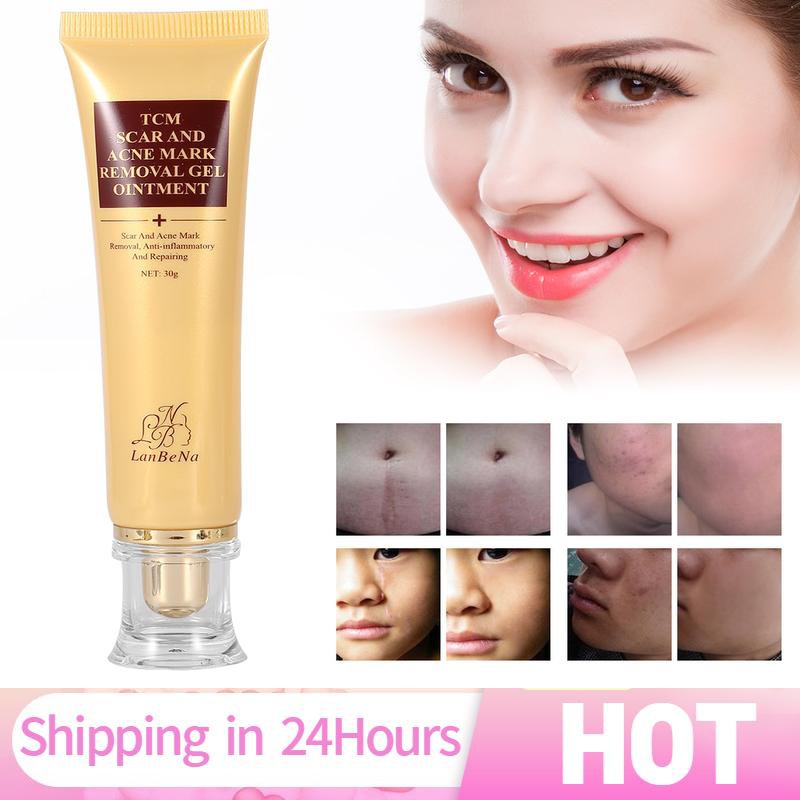 30g Scar Acne Mark Pimple Removal Remover Blemish Treatment Cream Ointment Shopee Philippines