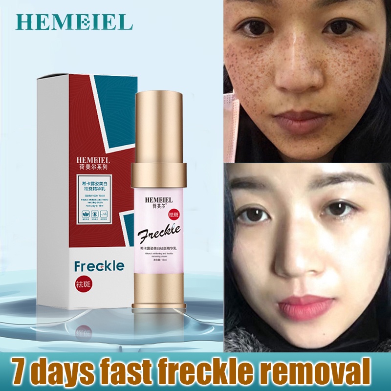 HEMEIEL 24k Melasma Cream Peka remover Collagen/Has Hyaluronic Acid And