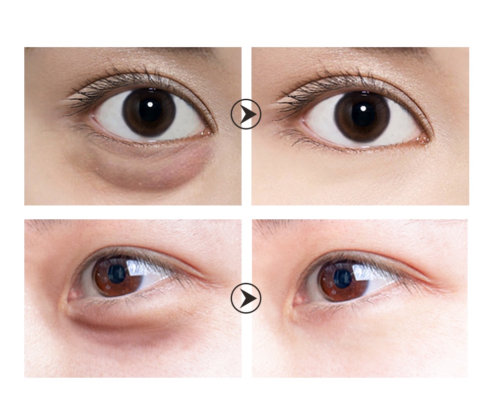 LANBENA Eye Mask Gold Black Pearl Collagen Antiaging Remove Eye Bag