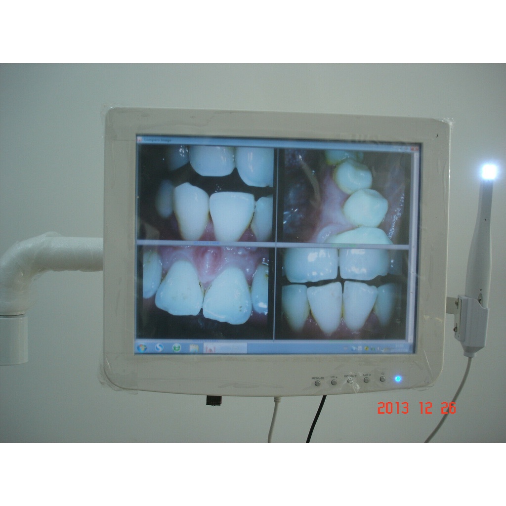 High Quality Dental Touch screen capacitive monitor with intraoral