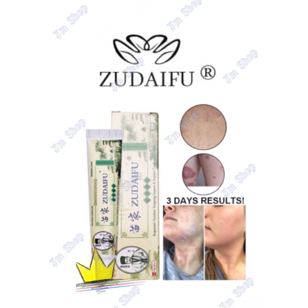 skin fighter cream original ♦New Original ZUDAIFU chinese herbal skin ...