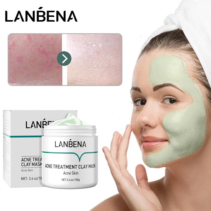 LANBENA Acne Treatment Clay Mask Acne Skin Deep Cleansing Remove