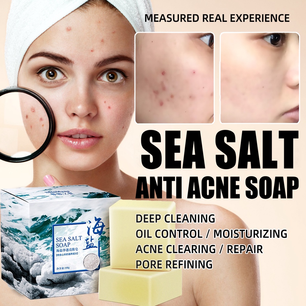 Sea Salt Soap Acne Treatment Removal Pimple Pores Goat Milk Face Wash