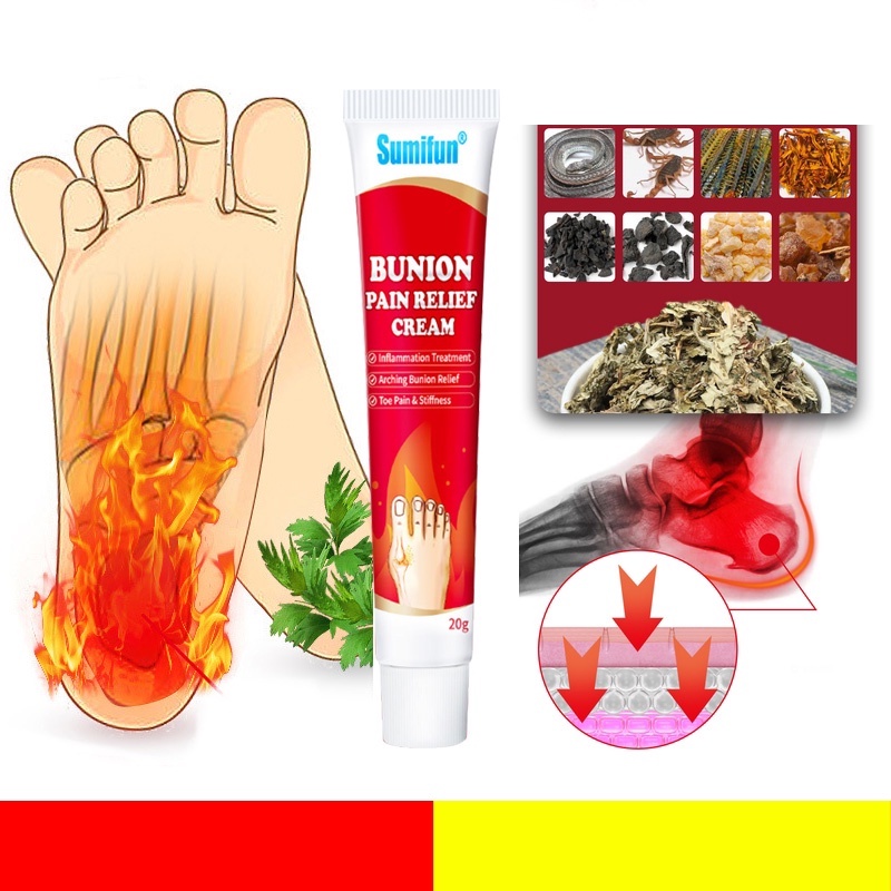 Sumifun gout cream 20g gout, arthritis, fujin, expel uric acid, relieve