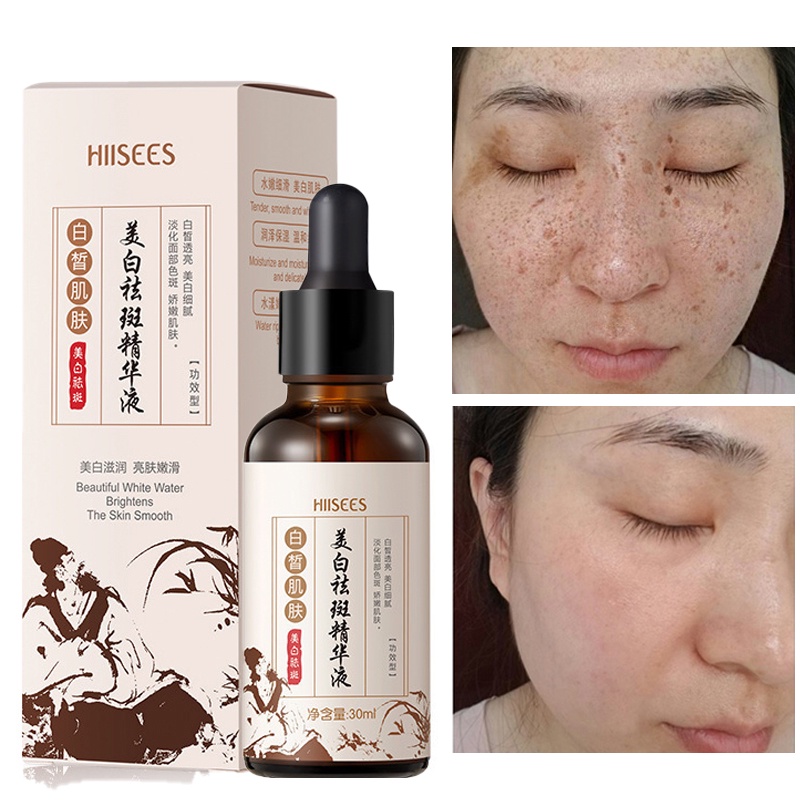Face Serum Moisturizing Improve Hyperpigmentation Fades Stains Brighten