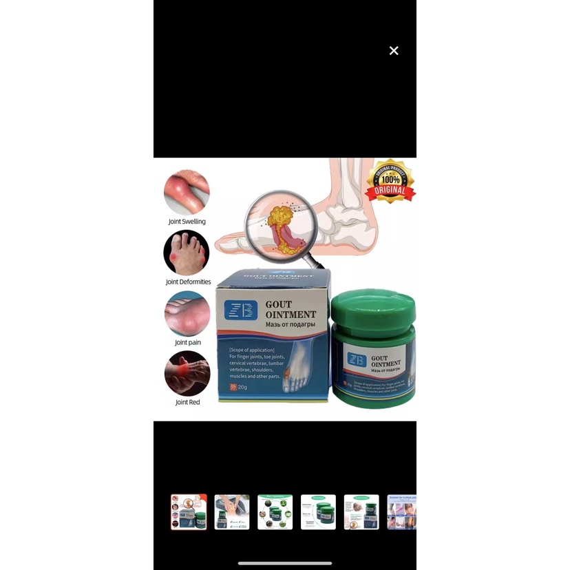 B.S Gout Ointment Treatment Gout Cause Joint Knee Pain Toe Finger Bone