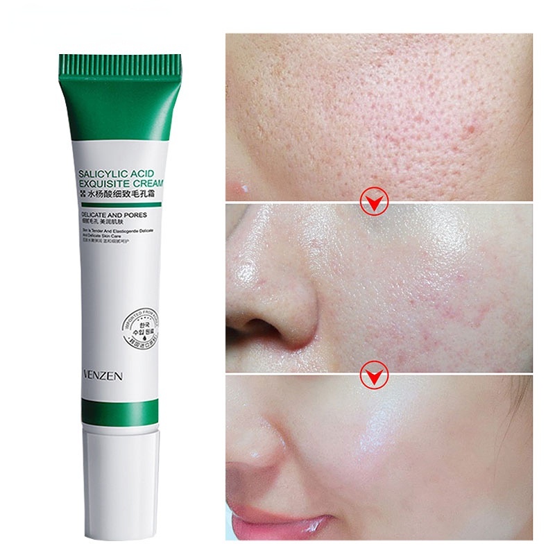 20ml Salicylic Acid Pores Refining Cream Shrink Pore Improve Acnes