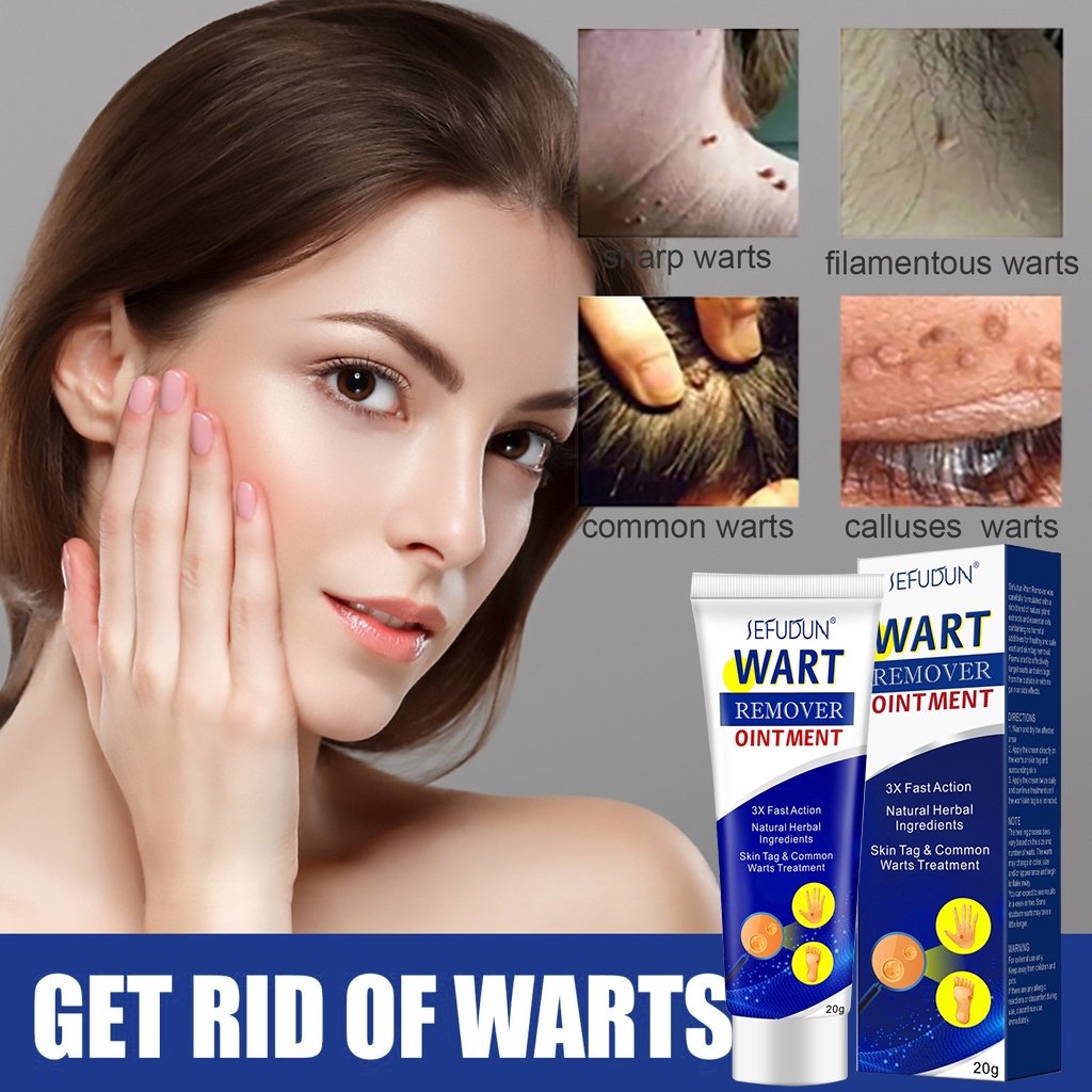 Sefudun Warts Remover Cream Mole Skin Tag Kulogo Genital Warts Remover