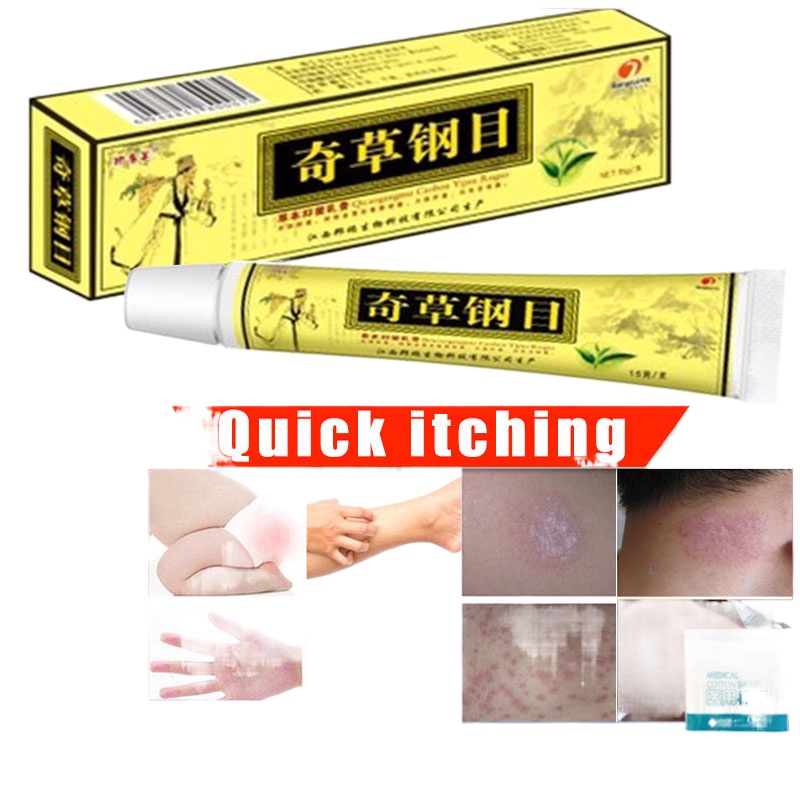 Chinese Herbal Eczema Psoriasis Cream Ointment Natural Herbal Cream for