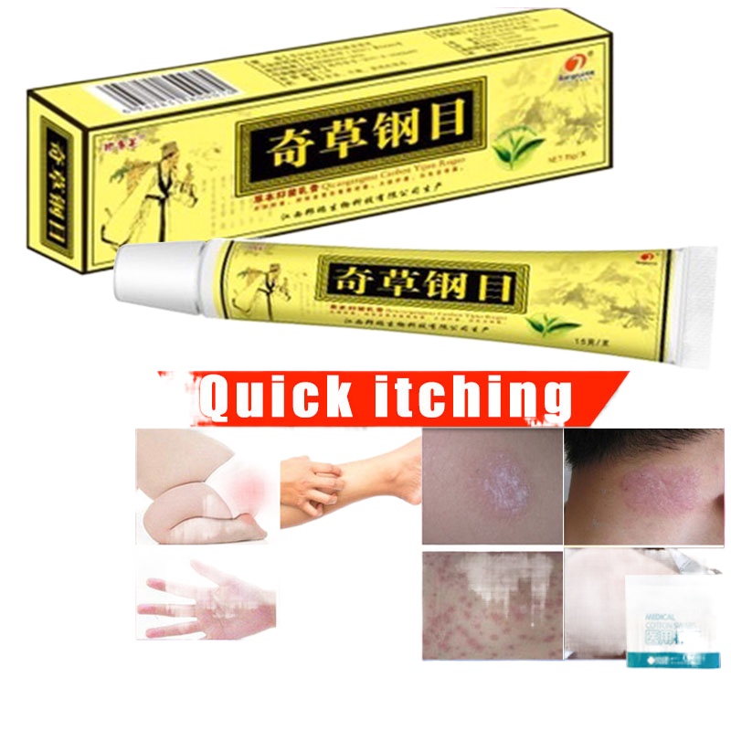 Chinese Herbal Eczema Psoriasis Cream Ointment Natural Herbal Cream for ...