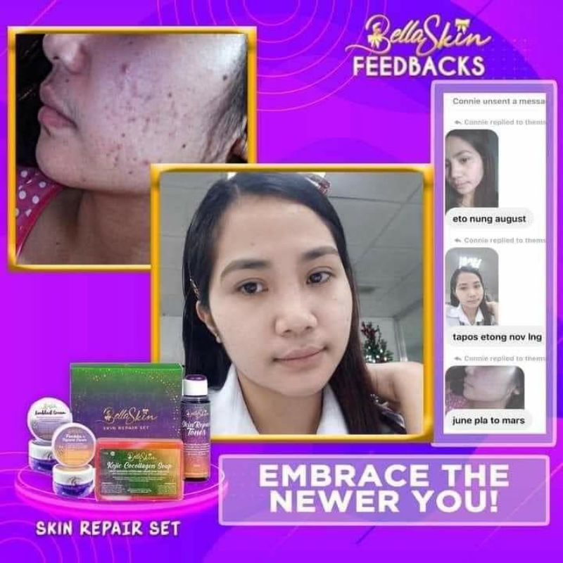 Bella skin repair set Shopee Philippines