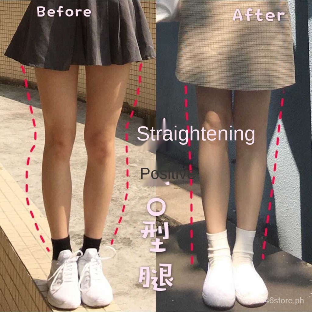 O-leg, X-leg orthosis Injury and sprain protection Leg straps Bow ...