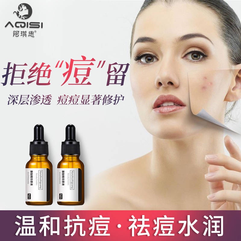 Oligopeptide concentrate remove youth acne marks fade acne scars pox