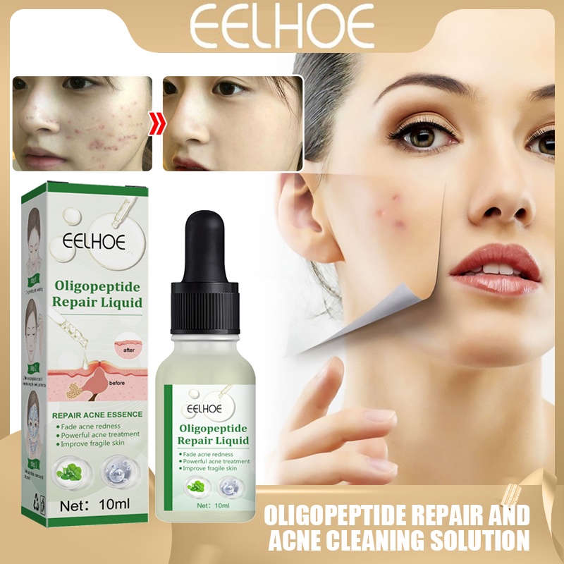 EELHOE Oligopeptide Repair Acne Cleansing Solution Hyaluronic Acid ...