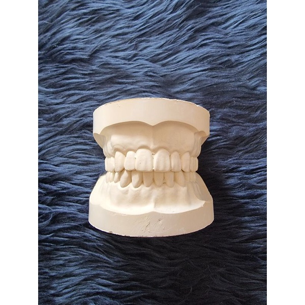 MrCenter03|Edentulous and Dentulous Study Casts: Comprehensive Dental ...