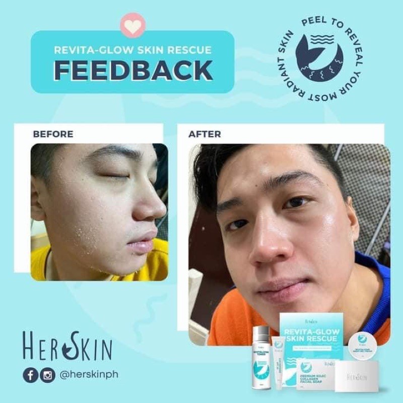 Her Skin Revita-Glow Skin Rescue Kit Shopee Philippines