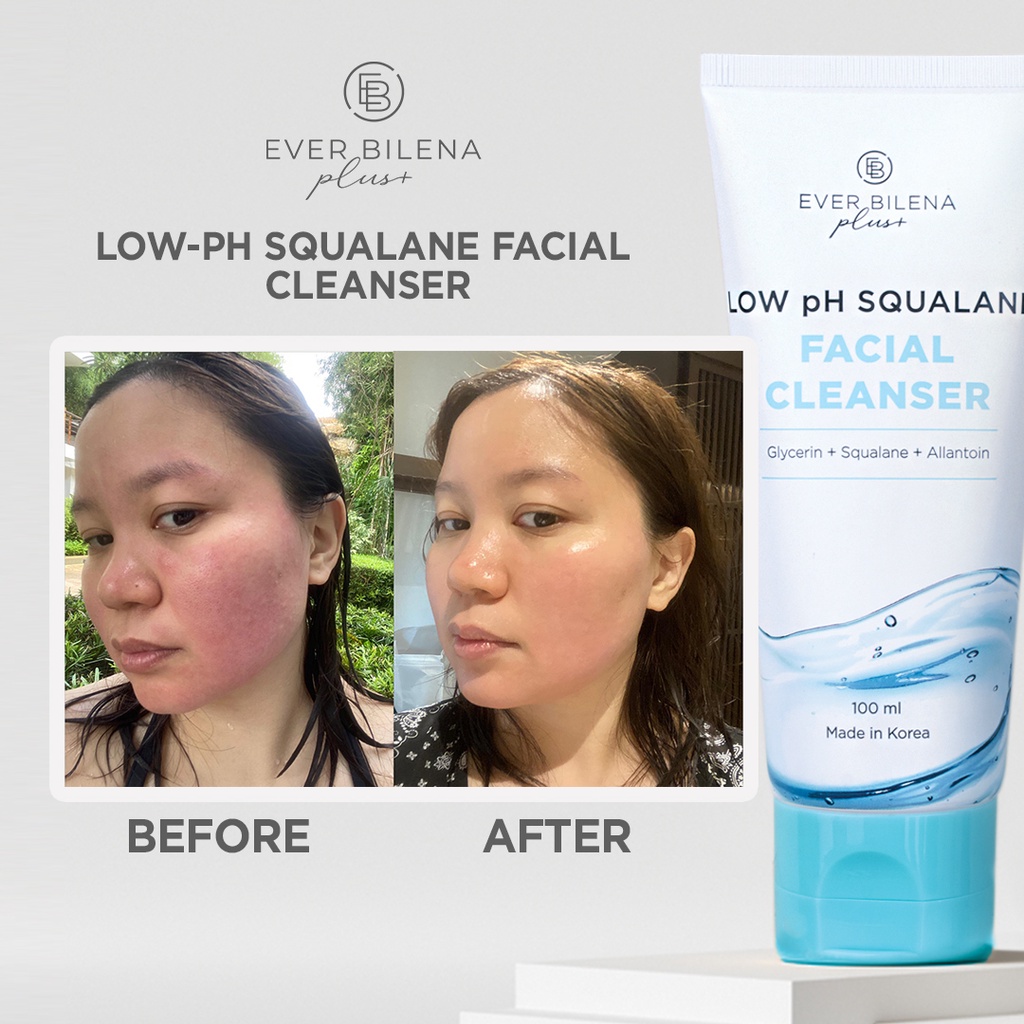 everlife BeKojun Perfect スキンケアセット
