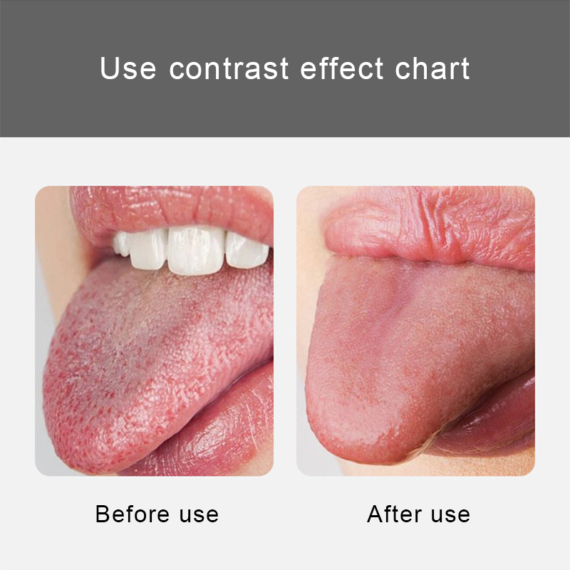 Stainless Steel Oral Hygiene Tongue Scraper Care Cleaning Tongue ...