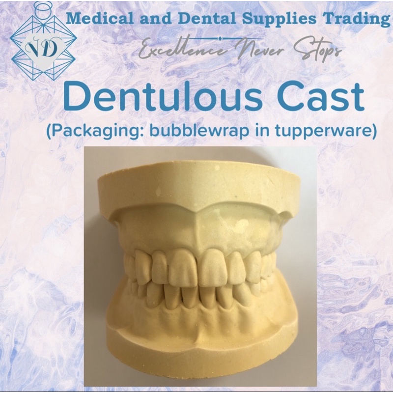 Dentulous Cast - Upper and Lower (packaging: bubblewrap in tupperware ...
