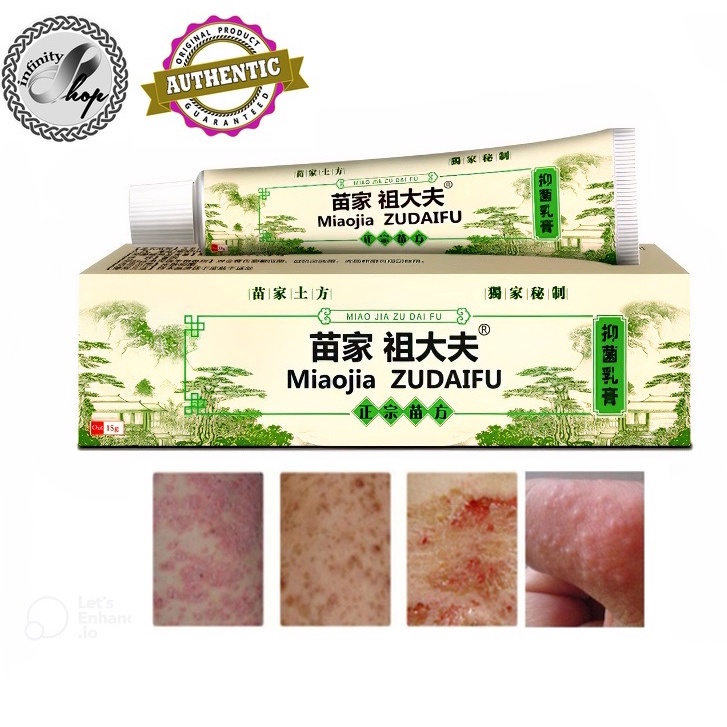 Authentic Miaojia Zudaifu Herbal Cream for Skin Diseases and Skin ...