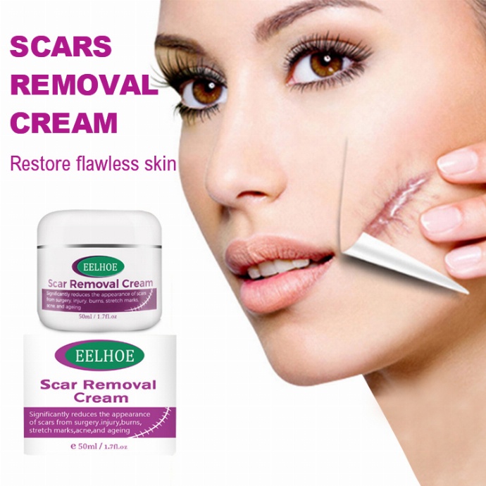 EELHOE Scars Removal Cream | Shopee Philippines