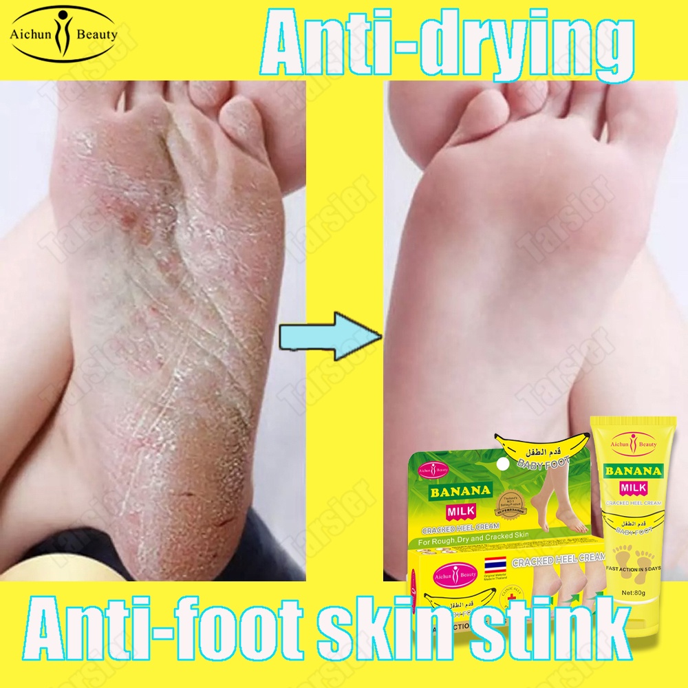 Authentic Aichun Foot Care Cream Foot Peeling Cracked Hands Hand And