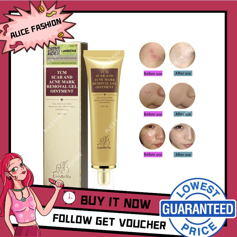 LANBENA Original TCM Herbal Acne Scar Removal Cream Spots Treatment ...