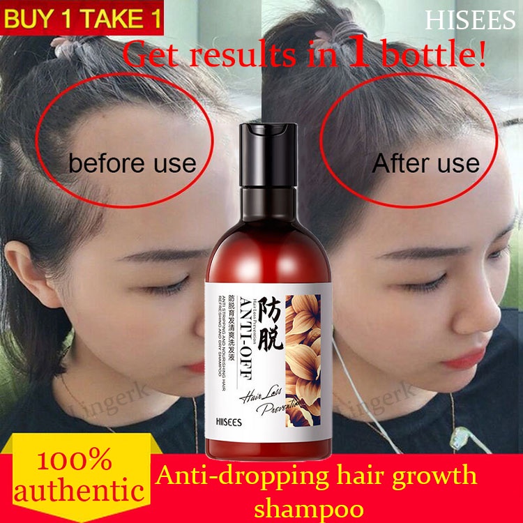 Hair growth shampoo control anti-dandruff anti-itch anti-hair fall ...