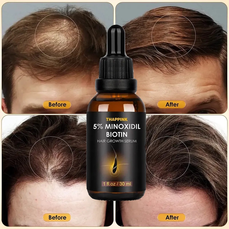 Minoxidil 5% Hair Growth Serum, Biotin Hair Regeneration Treatment ...