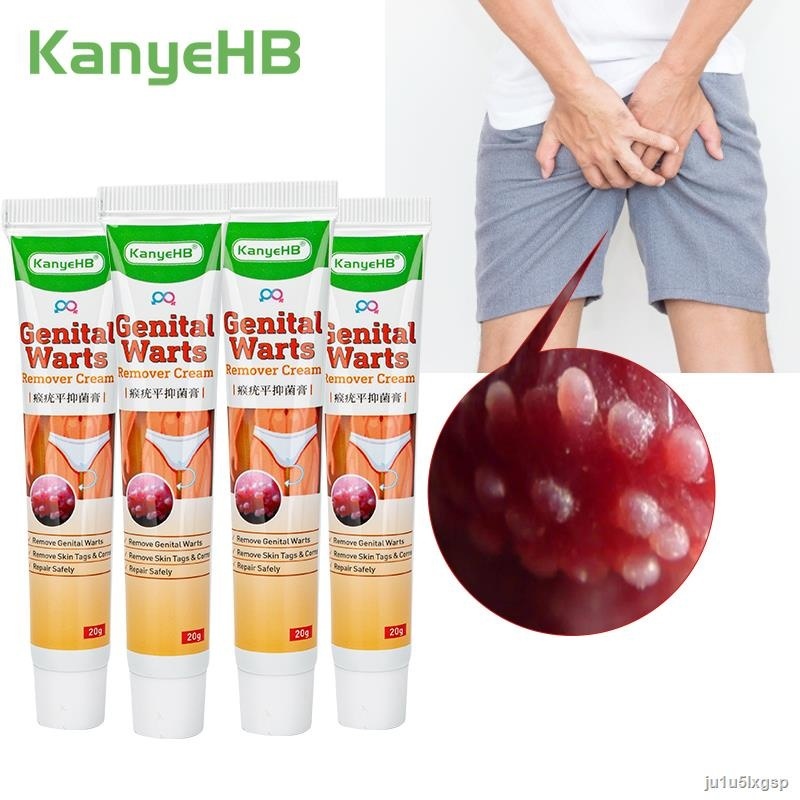 ☞remover cream skincare ointment kaso acne remover Private Flat