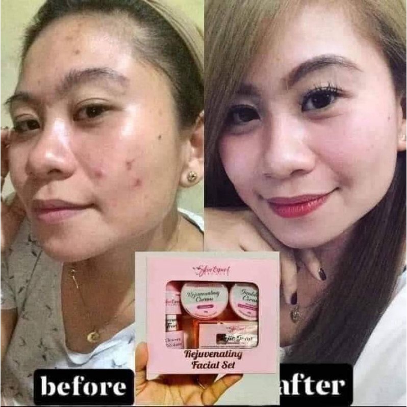 (cod)skin expert rejuvenating facial set complete | Shopee Philippines