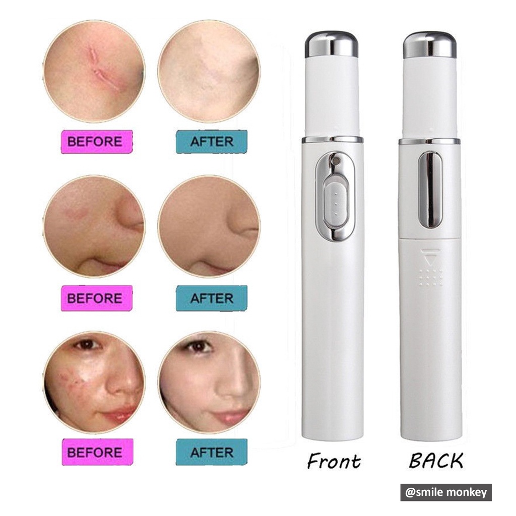 415nm Blue Light Laser Pen Acne Warts Pimple Remover Anti Aging Device