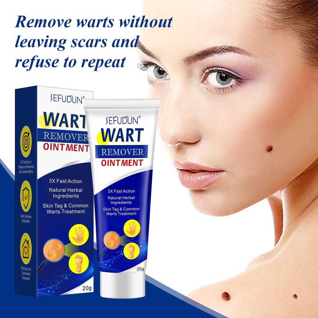 Sefudun Wart Remover Original Cream Wart Removal Ointment Warts And Skin Tags Remover 20g 0125