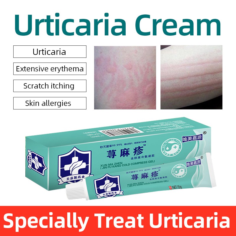 Herbal Medicine Urticaria Ointment Treatment Skin Dermatitis Psoriasis ...