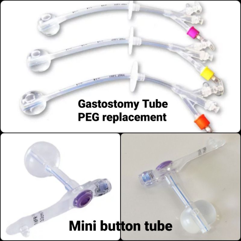 Gastrostomy Feeding Tube Silicone (Replacement tube 3 way, Button tube